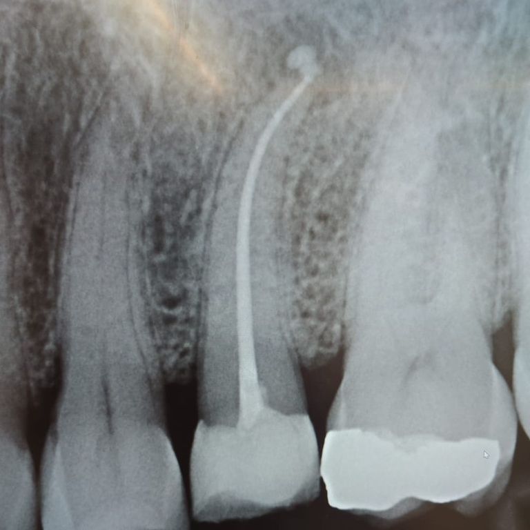 digital dental x-ray advanced diagnostics Vere Dental Battersea

