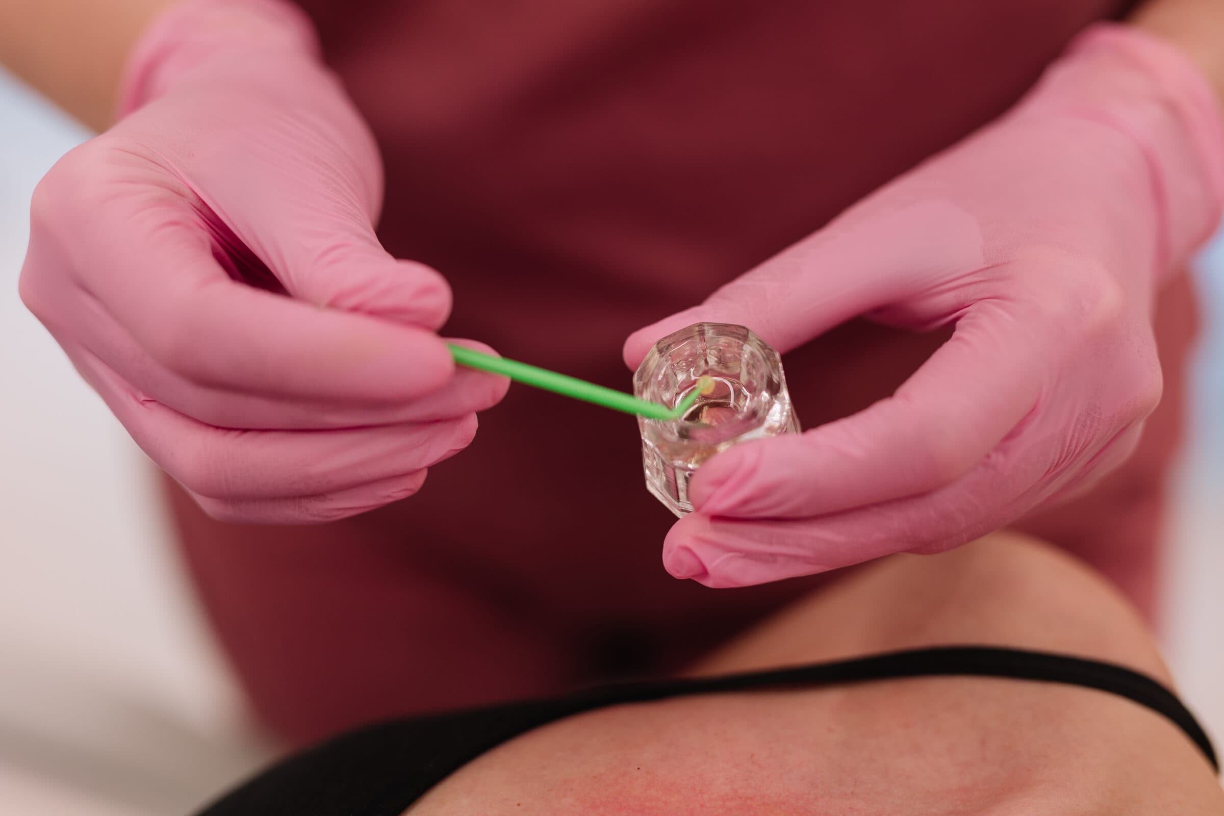 Summer Profhilo skin treatment